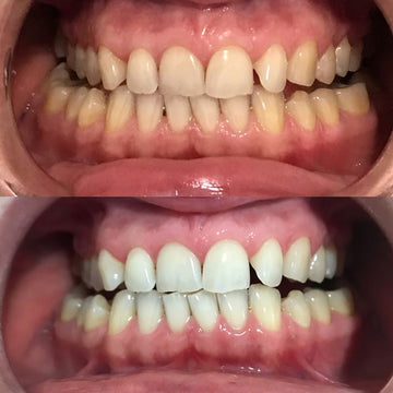 OFFICIAL ORAWRAP™ TRIAL RESULTS AFTER 10-DAYS.