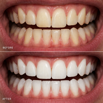 OFFICIAL ORAWRAP™ TRIAL RESULTS AFTER 10-DAYS.