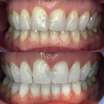 OFFICIAL ORAWRAP™ TRIAL RESULTS AFTER 10-DAYS.