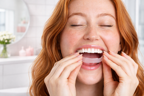 Woman with red hair applying a disposable dental tray product to her teeth in a bathroom setting.